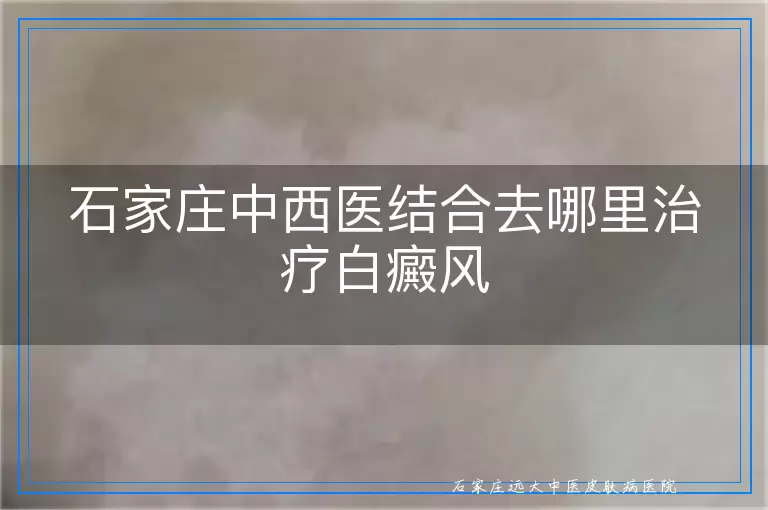 石家庄中西医结合去哪里治疗白癜风