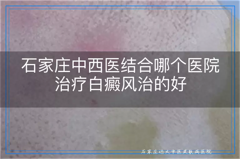 石家庄中西医结合哪个医院治疗白癜风治的好