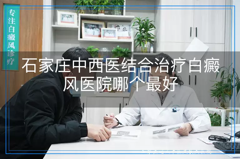 石家庄中西医结合治疗白癜风医院哪个最好