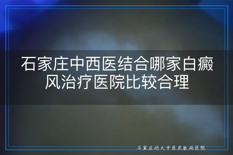 石家庄中西医结合哪家白癜风治疗医院比较合理