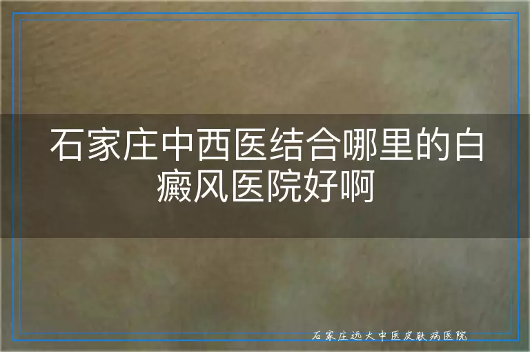 石家庄中西医结合哪里的白癜风医院好啊