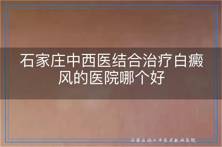 石家庄中西医结合治疗白癜风的医院哪个好