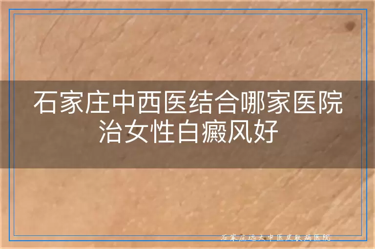 石家庄中西医结合哪家医院治女性白癜风好