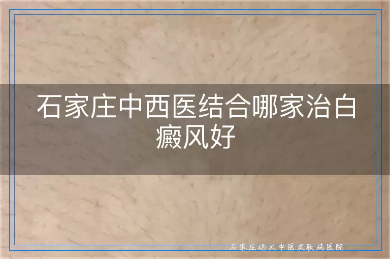 石家庄中西医结合哪家治白癜风好