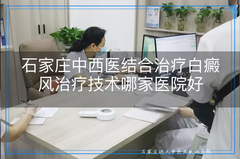 石家庄中西医结合治疗白癜风治疗技术哪家医院好