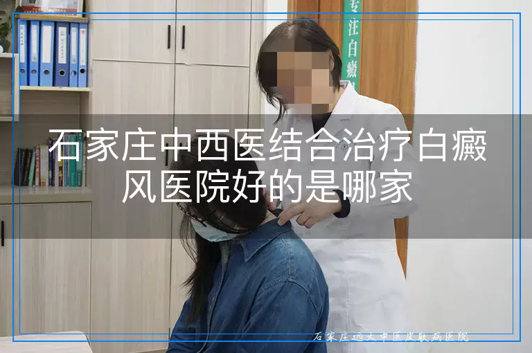 石家庄中西医结合治疗白癜风医院好的是哪家