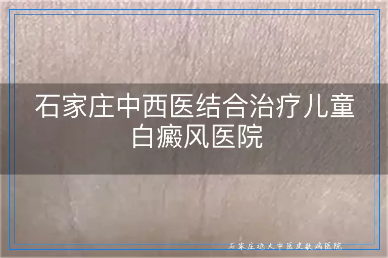 石家庄中西医结合治疗儿童白癜风医院