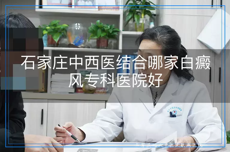 石家庄中西医结合哪家白癜风专科医院好