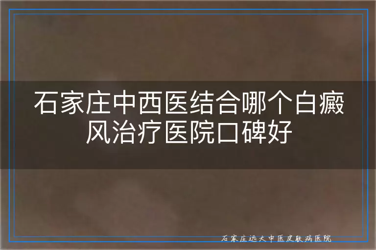 石家庄中西医结合哪个白癜风治疗医院口碑好