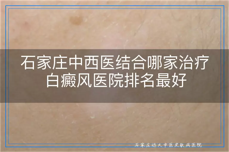 石家庄中西医结合哪家治疗白癜风医院排名最好