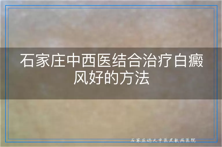石家庄中西医结合治疗白癜风好的方法