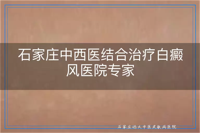 石家庄中西医结合治疗白癜风医院专家