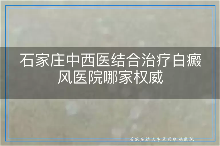 石家庄中西医结合治疗白癜风医院哪家权威