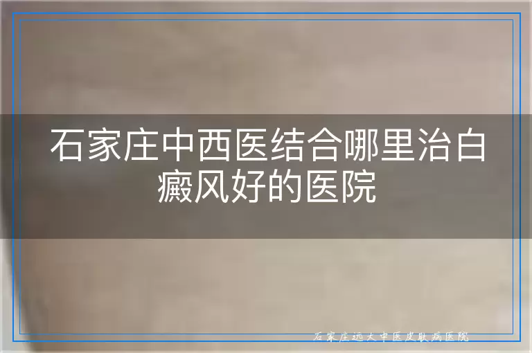 石家庄中西医结合哪里治白癜风好的医院