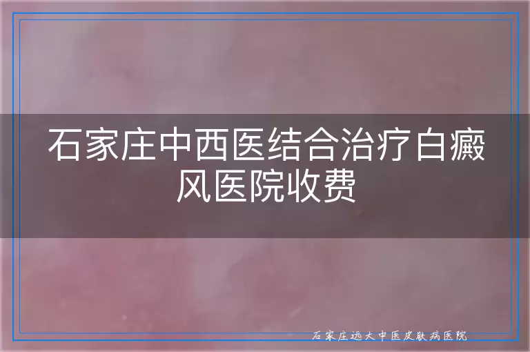 石家庄中西医结合治疗白癜风医院收费