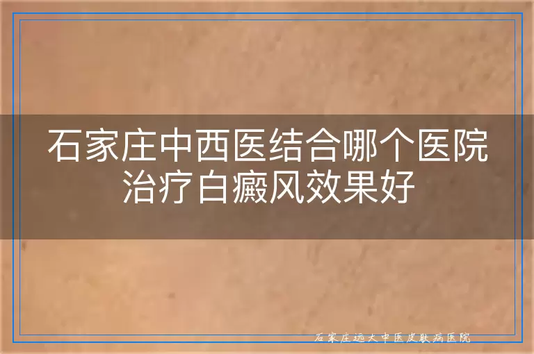 石家庄中西医结合哪个医院治疗白癜风效果好