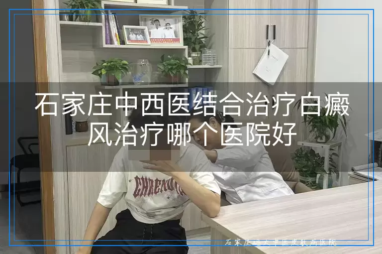 石家庄中西医结合治疗白癜风治疗哪个医院好
