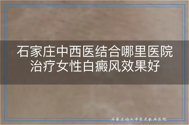 石家庄中西医结合哪里医院治疗女性白癜风效果好
