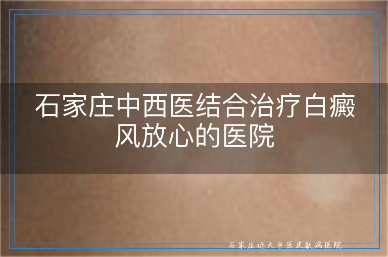 石家庄中西医结合治疗白癜风放心的医院