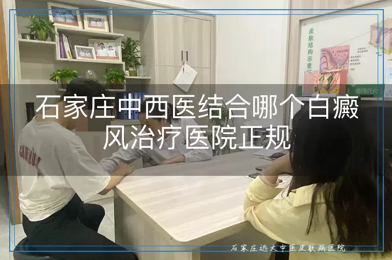 石家庄中西医结合哪个白癜风治疗医院正规