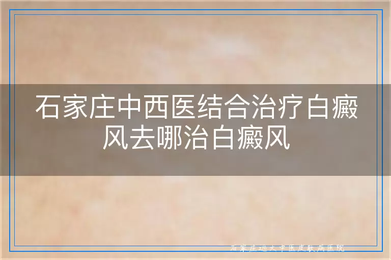 石家庄中西医结合治疗白癜风去哪治白癜风