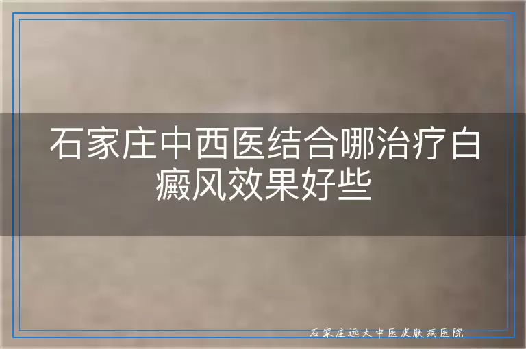 石家庄中西医结合哪治疗白癜风效果好些