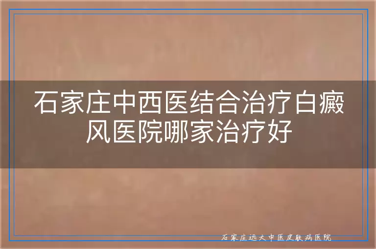 石家庄中西医结合治疗白癜风医院哪家治疗好