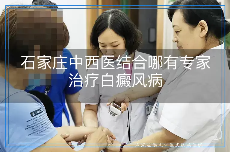 石家庄中西医结合哪有专家治疗白癜风病