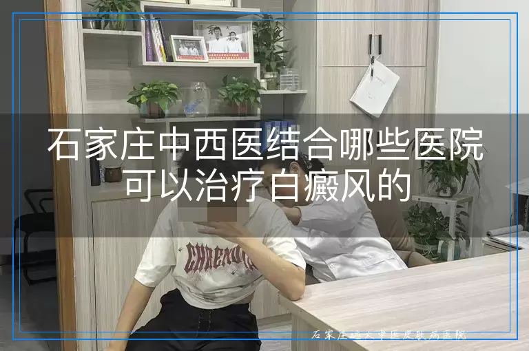 石家庄中西医结合哪些医院可以治疗白癜风的