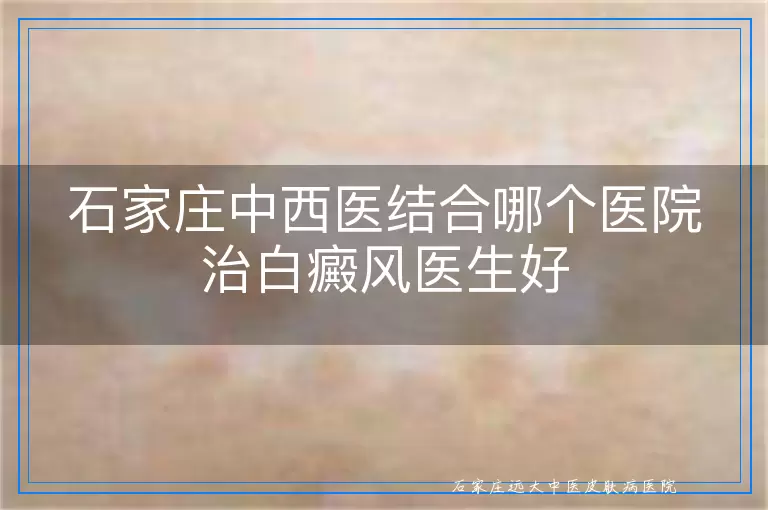 石家庄中西医结合哪个医院治白癜风医生好