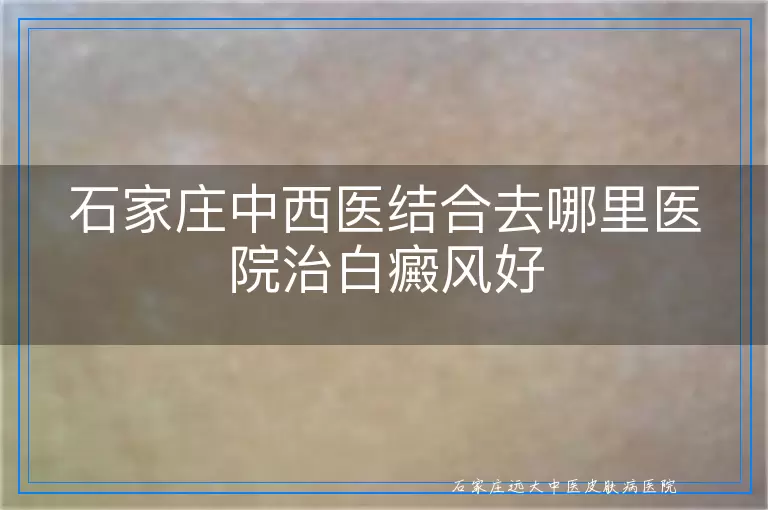 石家庄中西医结合去哪里医院治白癜风好