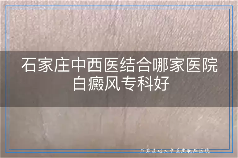 石家庄中西医结合哪家医院白癜风专科好