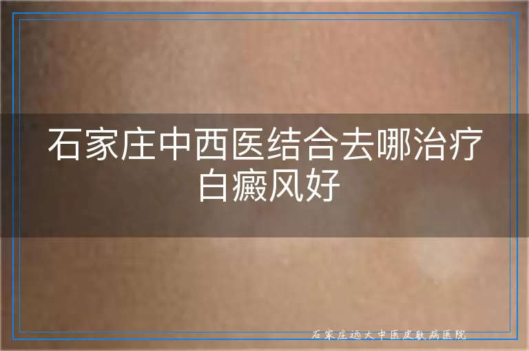 石家庄中西医结合去哪治疗白癜风好