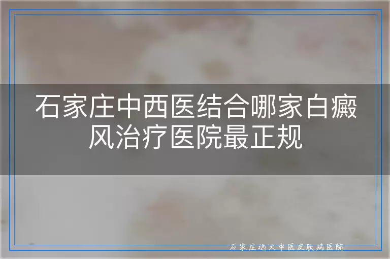 石家庄中西医结合哪家白癜风治疗医院最正规