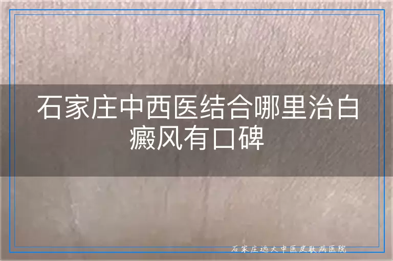 石家庄中西医结合哪里治白癜风有口碑