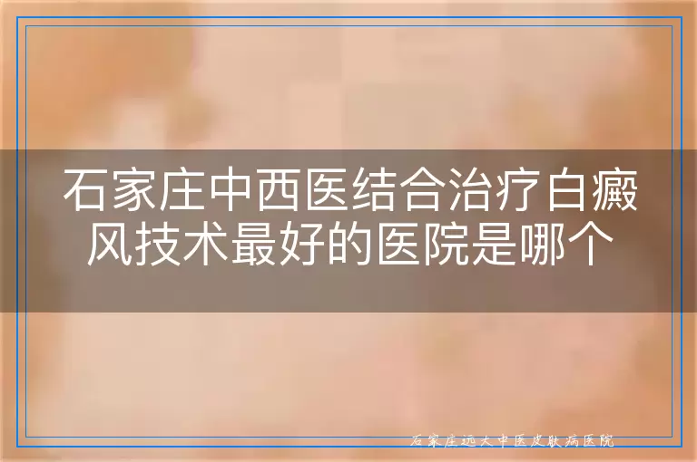 石家庄中西医结合治疗白癜风技术最好的医院是哪个