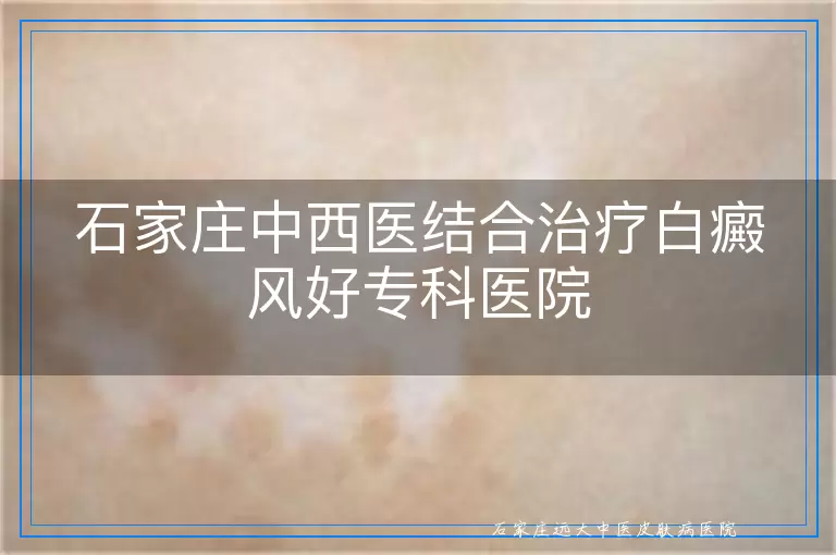 石家庄中西医结合治疗白癜风好专科医院