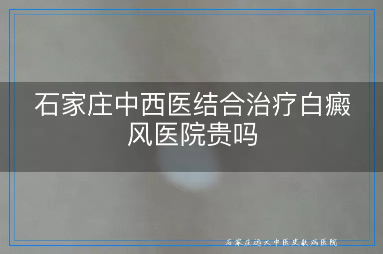 石家庄中西医结合治疗白癜风医院贵吗