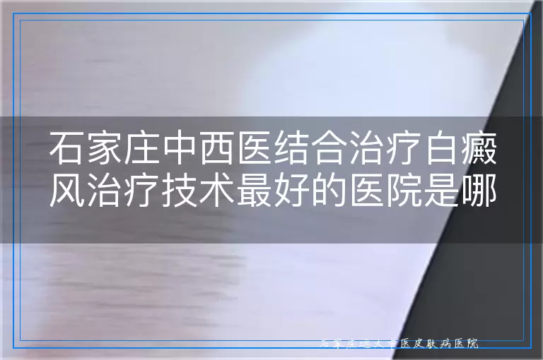 石家庄中西医结合治疗白癜风治疗技术最好的医院是哪家