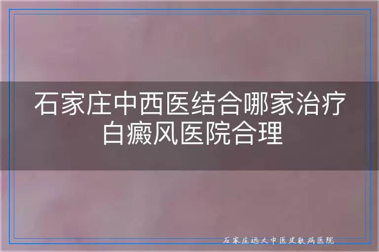 石家庄中西医结合哪家治疗白癜风医院合理