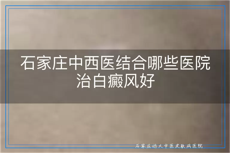 石家庄中西医结合哪些医院治白癜风好