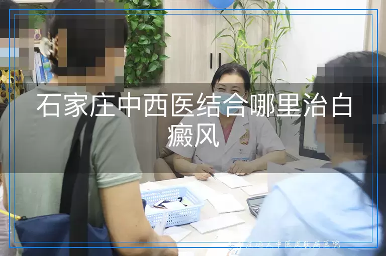 石家庄中西医结合哪里治白癜风