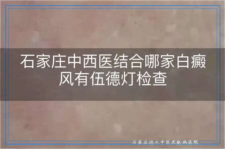 石家庄中西医结合哪家白癜风有伍德灯检查