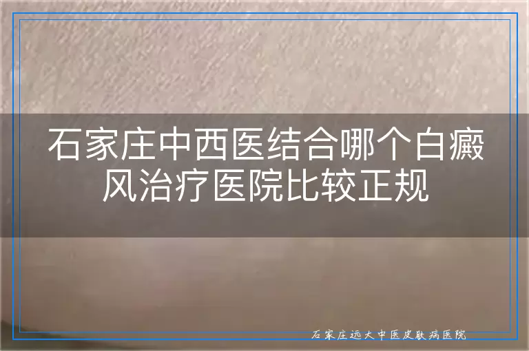 石家庄中西医结合哪个白癜风治疗医院比较正规