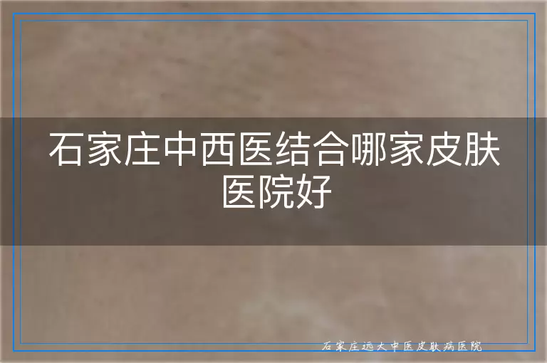 石家庄中西医结合哪家皮肤医院好