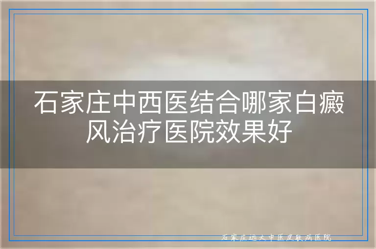 石家庄中西医结合哪家白癜风治疗医院效果好