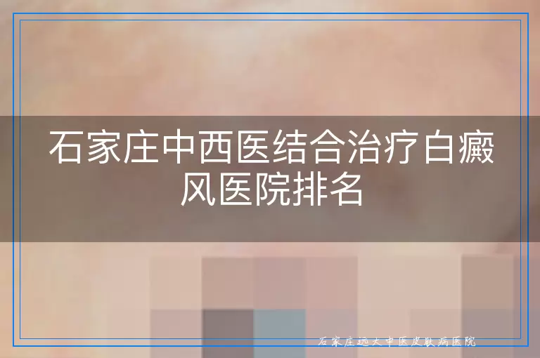 石家庄中西医结合治疗白癜风医院排名