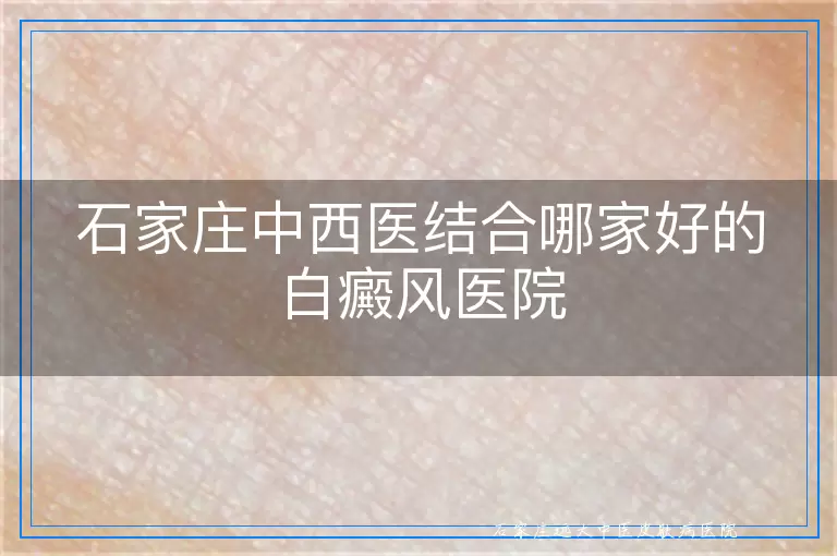 石家庄中西医结合哪家好的白癜风医院