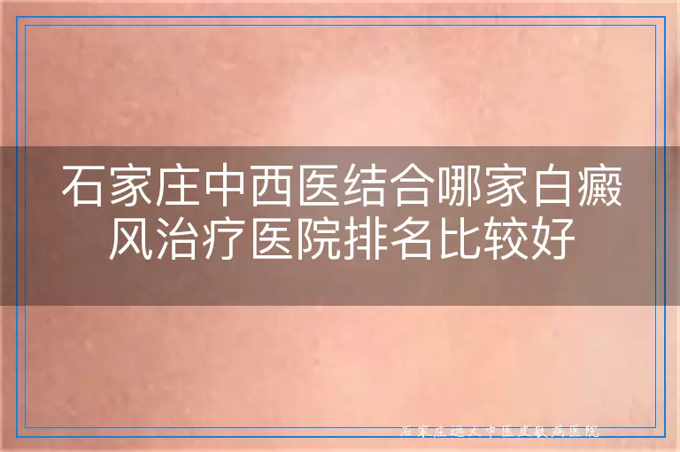 石家庄中西医结合哪家白癜风治疗医院排名比较好