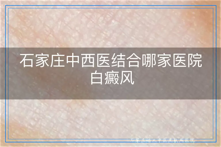 石家庄中西医结合哪家医院白癜风